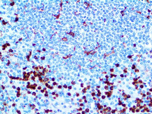 IHC of CD11b on an FFPE Spleen Tissue